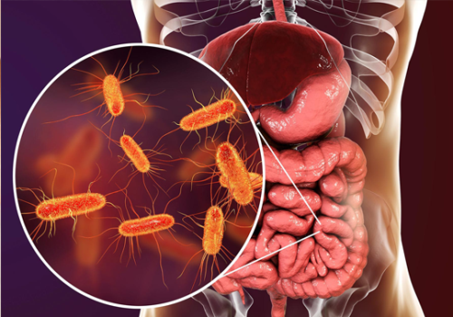 Digestive-Issues-Gut-Health-wellness-centre-nerang.png